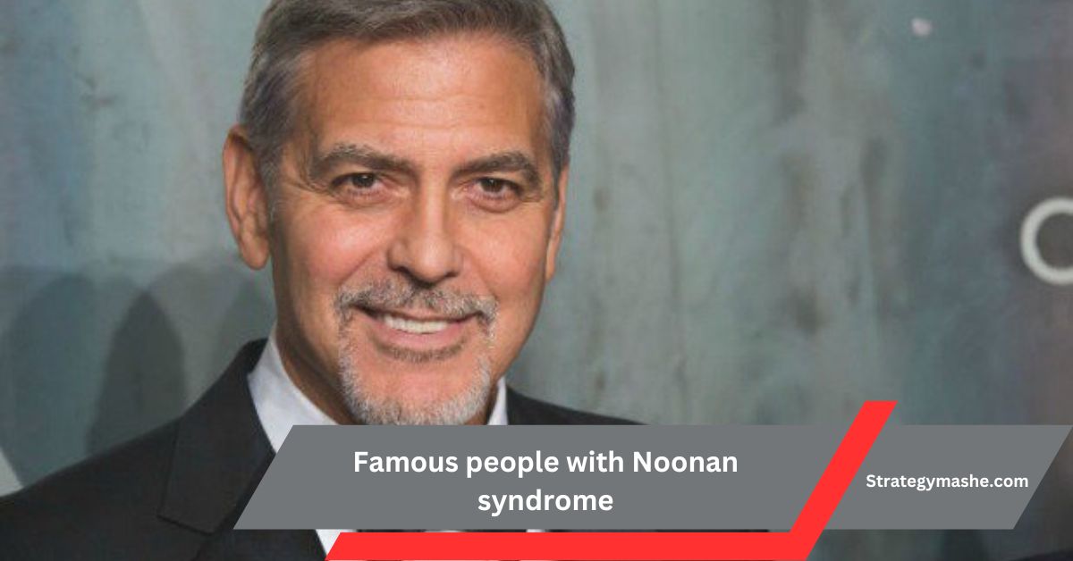 Famous people with Noonan syndrome – Explore Their Stories!